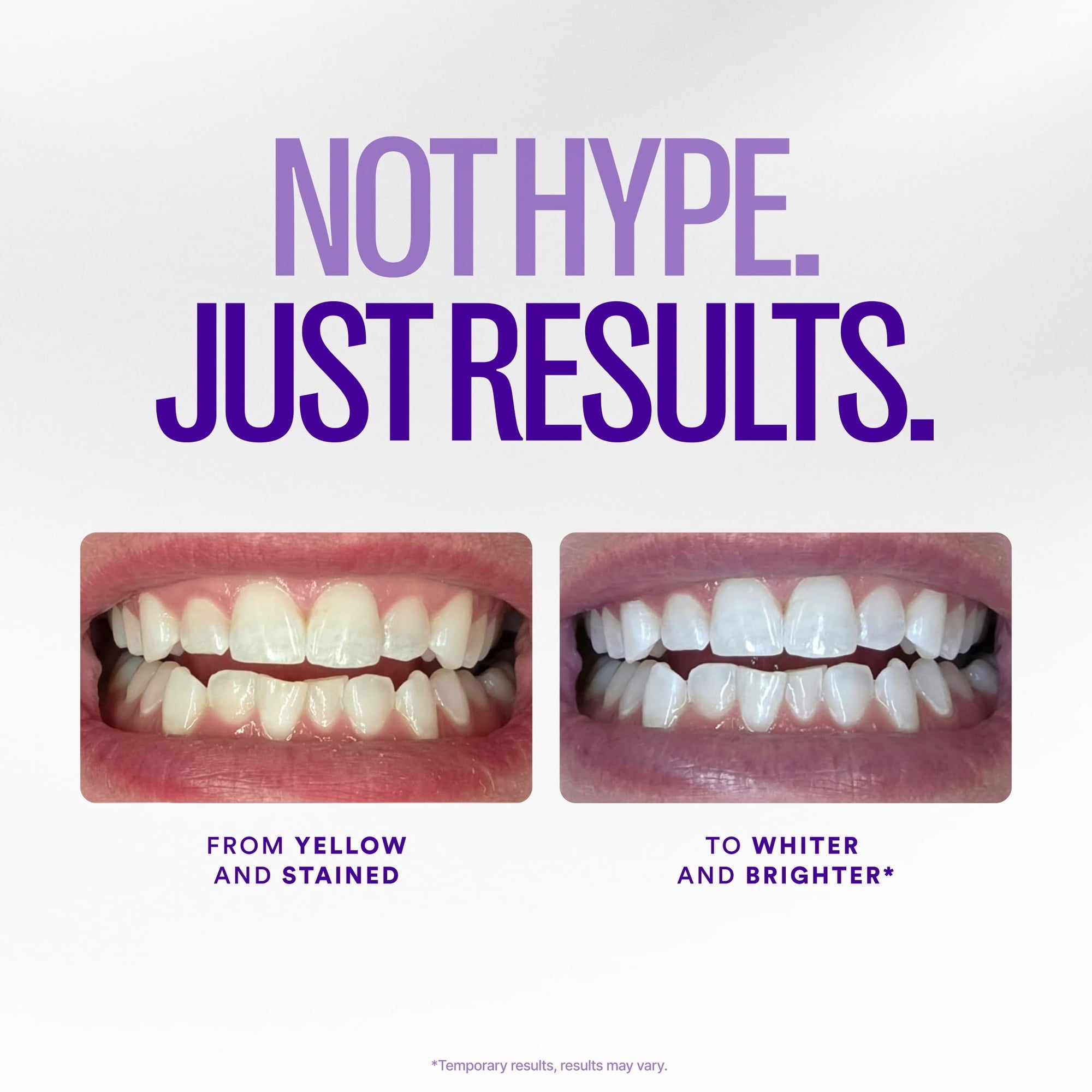 Purple Instant Whitening Strips – 14 par (28 szt.) | Wybielanie bez nadwrażliwości